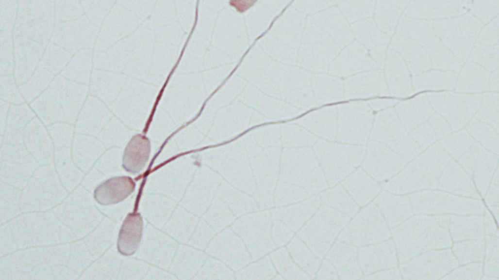 Sperma under mikroskop.