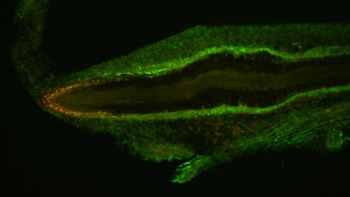Microscope image of an elongated structure. Photo.