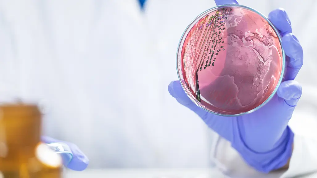 A hand wearing plastic gloves holding a petri dish, half of it containing a cultivation of bacteria, half of it the surface of Earth and the continents.